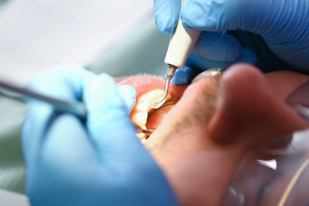Best Emergency Root Canal Treatment in Nicholson, MS