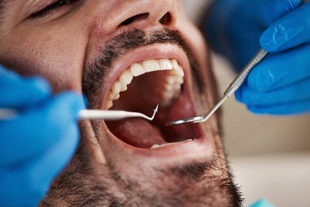 Fast & Reliable Emergency Dental Services in MS