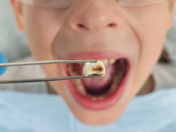 Best Cosmetic Emergency Dentistry in Nicholson, MS