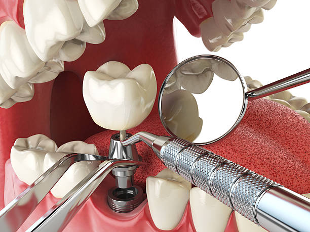 Best Pediatric Emergency Dentist in Nicholson, MS